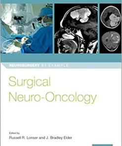 Surgical Neuro-Oncology (Neurosurgery by Example) 1st Edition PDF