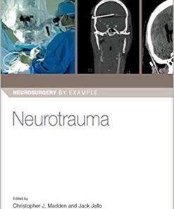 Neurotrauma (Neurosurgery by Example) 1st Edition PDF