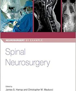 Spinal Neurosurgery (Neurosurgery by Example) 1st Edition PDF