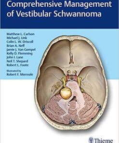 Comprehensive Management of Vestibular Schwannoma 1st Edition PDF