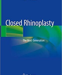 Closed Rhinoplasty: The Next Generation 1st ed. 2019 Edition PDF