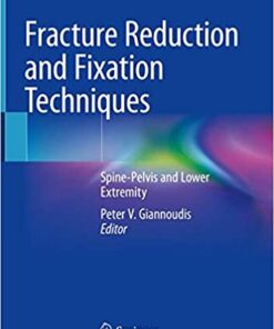 Fracture Reduction and Fixation Techniques: Spine-Pelvis and Lower Extremity 1st ed. 2020 Edition PDF