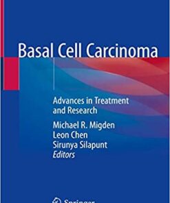 Basal Cell Carcinoma: Advances in Treatment and Research 1st ed. 2020 Edition PDF