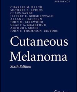 Cutaneous Melanoma 6th ed. 2020 Edition PDF