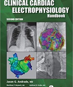 The Clinical Cardiac Electrophysiology Handbook, Second Edition 2nd Edition PDF