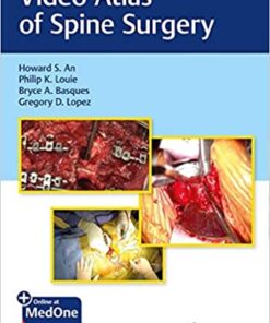 Video Atlas of Spine Surgery 1st Edition PDF & VIDEO