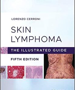 Skin Lymphoma: The Illustrated Guide 5th Edition PDF