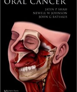 Oral Cancer ​PDF