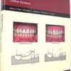 Removable partial denture design: Outline syllabus PDF