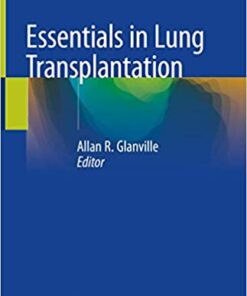 Essentials in Lung Transplantation (Englisch) 1st ed. 2019 Auflage PDF