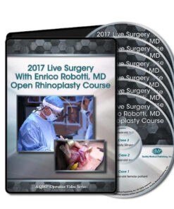 2017 Live Surgery With Enrico Robotti Open Rhinoplasty Course