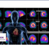 Nuclear Cardiology Board Review 2018