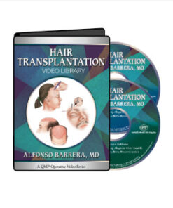 Hair Transplantation video 2017