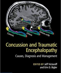 Concussion and Traumatic Encephalopathy: Causes, Diagnosis and Management 1st Edition PDF