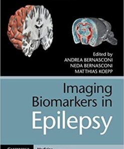 Imaging Biomarkers in Epilepsy 1st Edition PDF