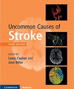 Uncommon Causes of Stroke 3rd Edition PDF