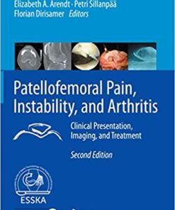 Patellofemoral Pain, Instability, and Arthritis: Clinical Presentation, Imaging, and Treatment 2nd ed. 2020 Edition PDF