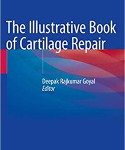 The Illustrative Book of Cartilage Repair 1st ed. 2021 Edition PDF