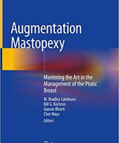 Augmentation Mastopexy: Mastering the Art in the Management of the Ptotic Breast 1st ed. 2020 Edition PDF