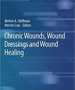 Chronic Wounds, Wound Dressings and Wound Healing 1st ed. 2021 Edition PDF