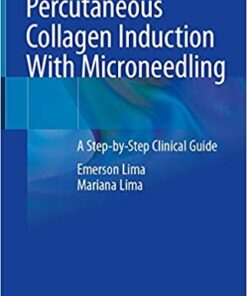 Percutaneous Collagen Induction With Microneedling: A Step-by-Step Clinical Guide 1st ed. 2021 Edition PDF