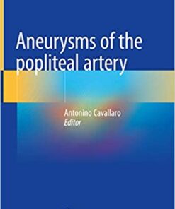 Aneurysms of the Popliteal Artery 1st ed. 2021 Edition PDF