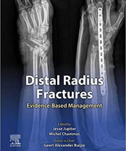 Distal Radius Fractures: Evidence-Based Management 1st Edition PDF