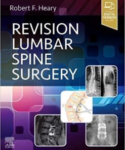 Revision Lumbar Spine Surgery 1st Edition PDF