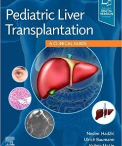 Pediatric Liver Transplantation: A Clinical Guide 1st Edition PDF