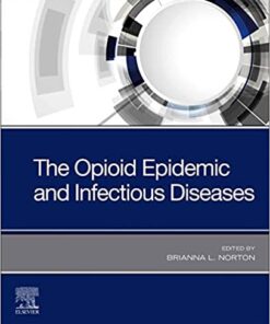 The Opioid Epidemic and Infectious Diseases 1st Edition PDF