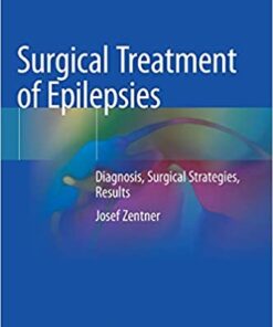 Surgical Treatment of Epilepsies: Diagnosis, Surgical Strategies, Results 1st ed. 2020 Edition PDF