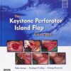 The Keystone Perforator Island Flap Concept PDF