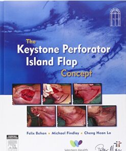 The Keystone Perforator Island Flap Concept PDF