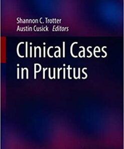 Clinical Cases in Pruritus (Clinical Cases in Dermatology) 1st ed. 2021 PDF