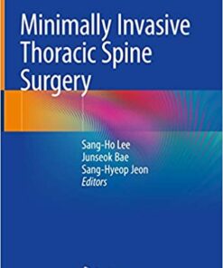 Minimally Invasive Thoracic Spine Surgery 1st ed. 2021 Edition PDF