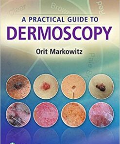 A Practical Guide to Dermoscopy 1st Edition PDF