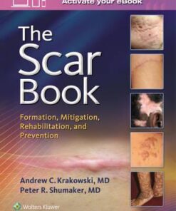 The Scar Book: Formation, Mitigation, Rehabilitation and Prevention 1st Edition PDF