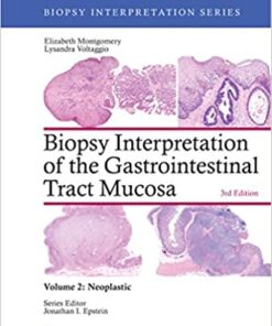 Biopsy Interpretation of the Gastrointestinal Tract Mucosa: Volume 2: Neoplastic  Third Edition PDF