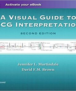 A Visual Guide to ECG Interpretation Second Edition PDF