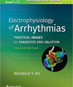 Electrophysiology of Arrhythmias: Practical Images for Diagnosis and Ablation 2nd Edition PDF