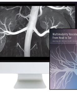 ARRS Multimodality Vascular Imaging: From Head to Toe 2020