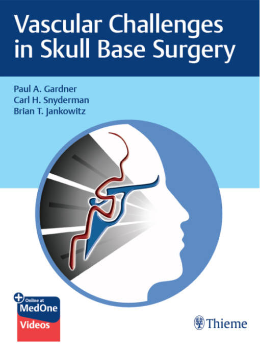 Vascular Challenges in Skull Base Surgery 1st Edition PDF & VIDEO