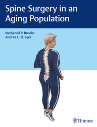 Spine Surgery in an Aging Population 1st Edition PDF