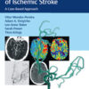 Endovascular Management of Ischemic Stroke: A Case-Based Approach 1st Edition PDF