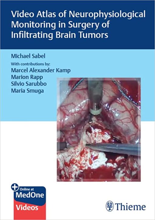 Video Atlas of Neurophysiological Monitoring in Surgery of Infiltrating Brain Tumors 1st Edition PDF