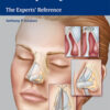 Rhinoplasty: The Experts' Reference 1st Edition PDF