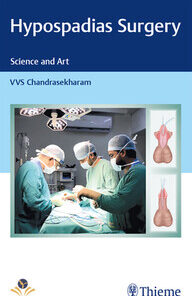 Hypospadias Surgery - Science and Art PDF