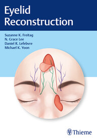 Eyelid Reconstruction 1st Edition PDF