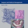 Salivary Gland Diseases: Surgical and Medical Management 1st Edition PDF