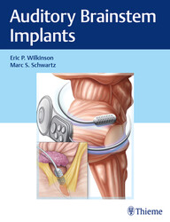 Auditory Brainstem Implants 1st Edition PDF